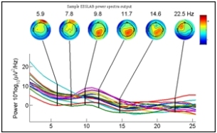 Graphic_of_EEG.jpg